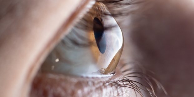 Aanpassing richtlijn Uveitis, module Behandeling actieve toxoplasmose chorioretinitis.