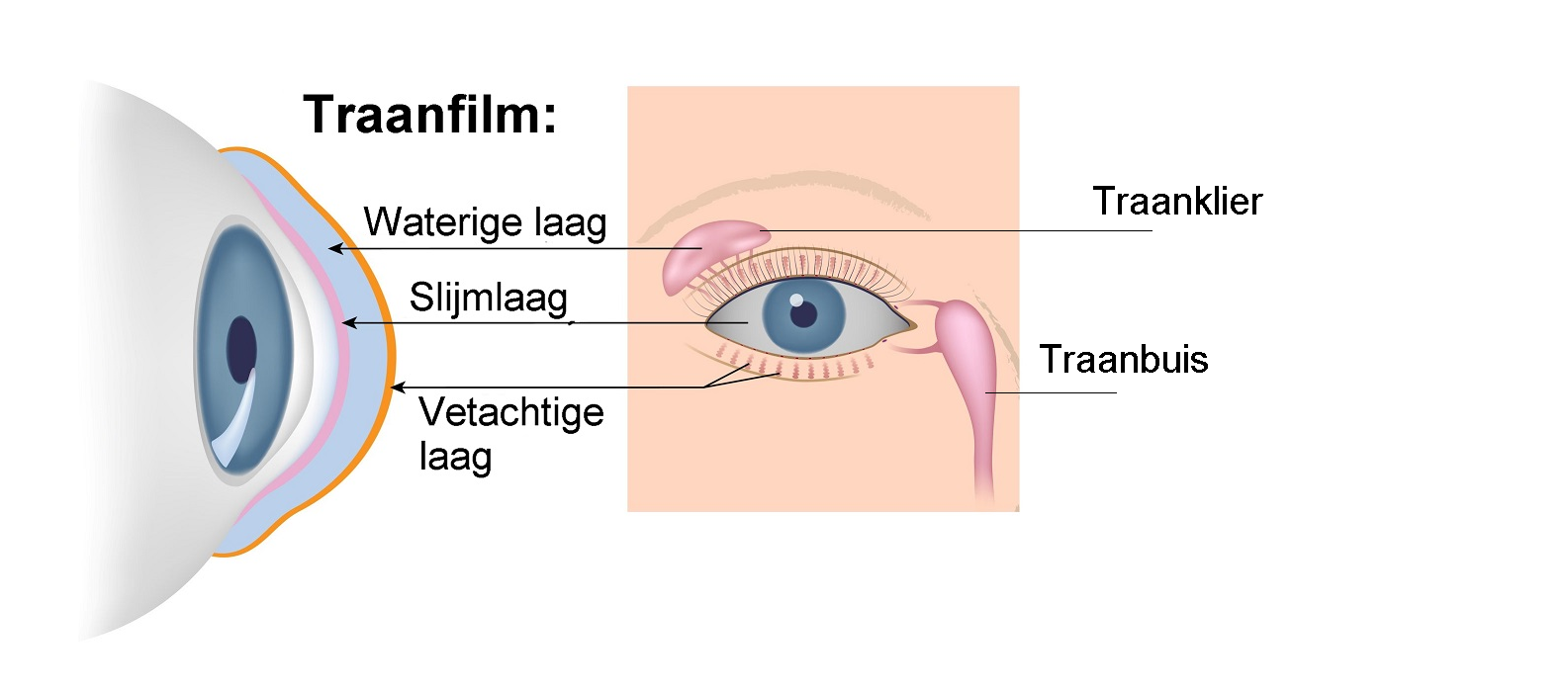 dilemma kas Pardon Droge ogen | Optometristen Vereniging Nederland (OVN)